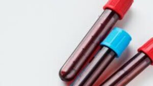 Cancer Detection