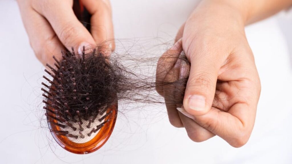 Hair Fall