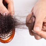 How To Control Hair Fall In Summer Naturally